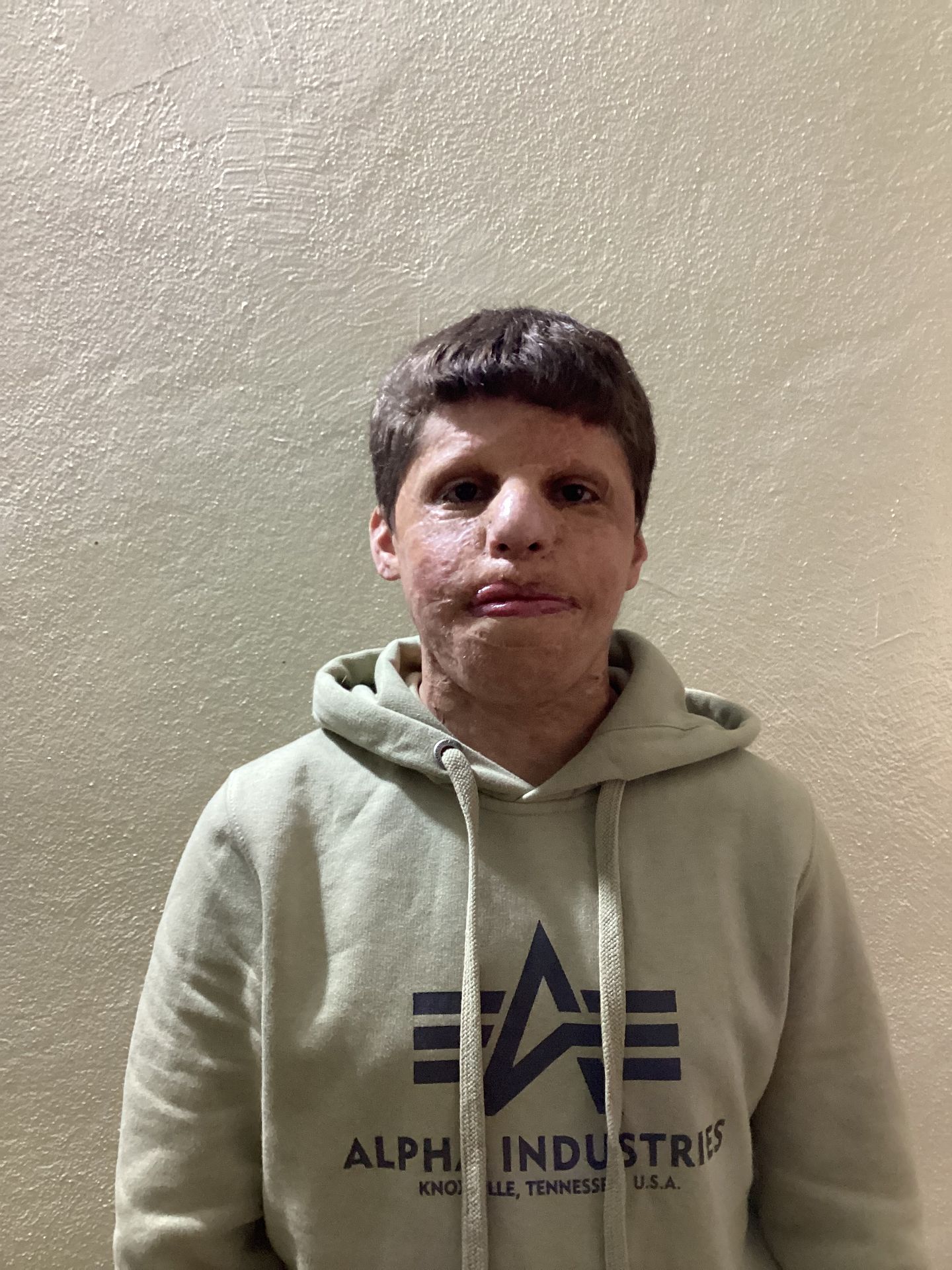 Human Appeal Orphan - Ismail